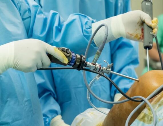 Arthroscopy