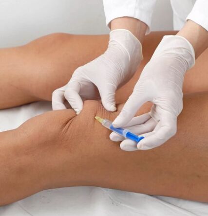 Ozonotherapy