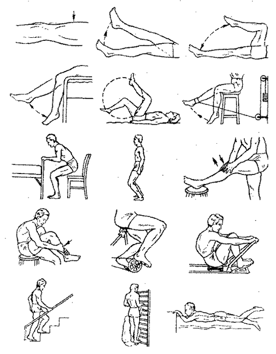 Therapeutic exercises for knee joint arthritis